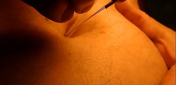  Belly Play piercing with acupuncture needles